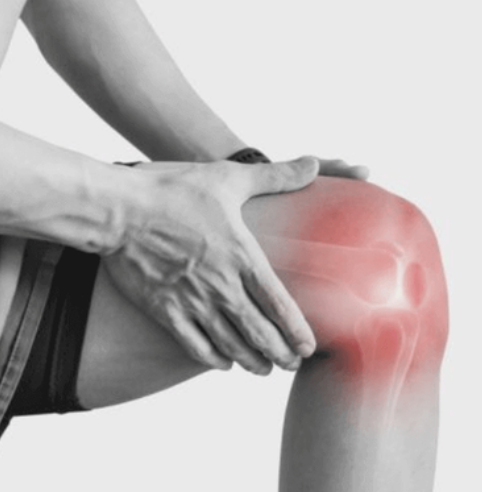 Knee Replacement Surgery